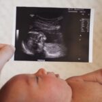 babyboyultrasound-7bf2ced4b4794754b67dea974b7ec744-b1fdc96400bf48a597dd383c03ac7345