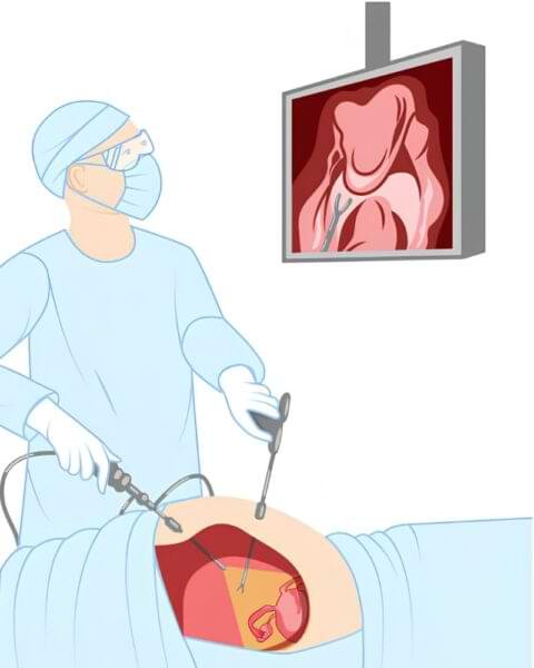 Best 3D laparoscopy hospital in Ahmedabad - Prabhu Hospital operation theatre