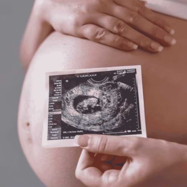 Expecting parents during 3D 4D sonography scan