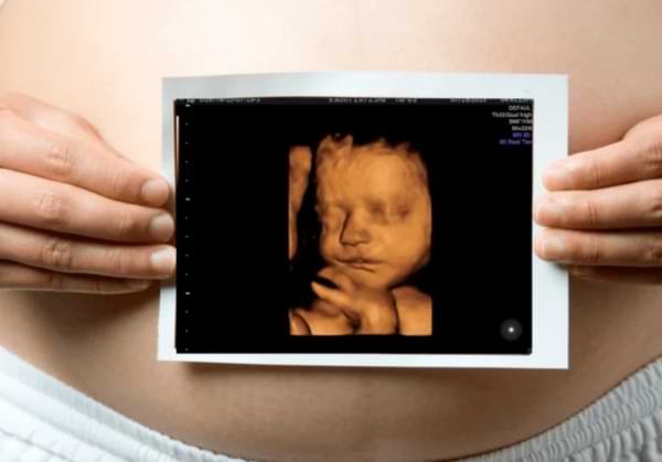 High quality 3D 4D fetal imaging technology