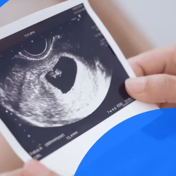 Sonography