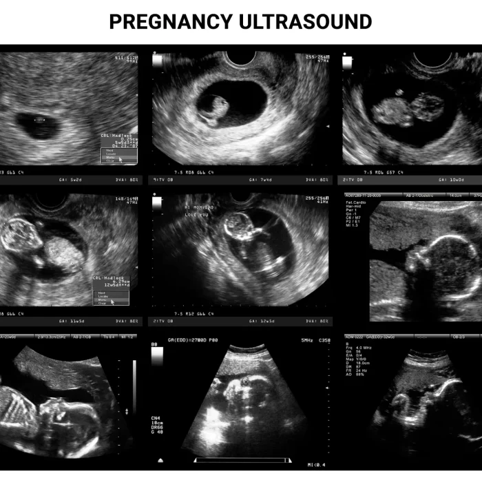 black and white Sonography