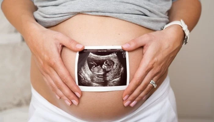 3d Sonography