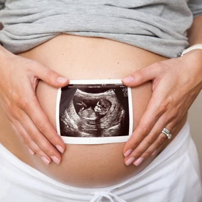 3d Sonography