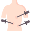 laparoscopy