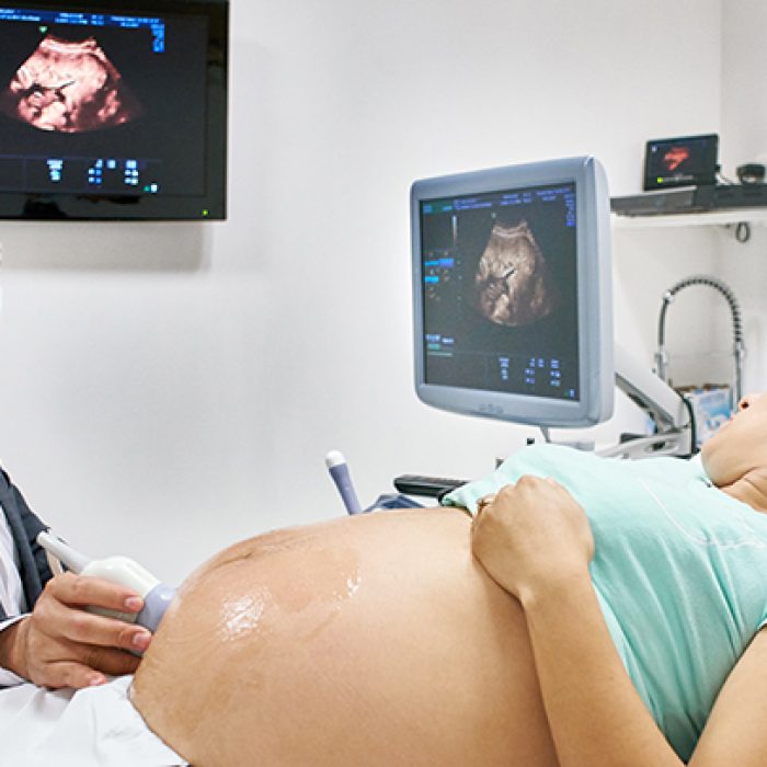 Sonography